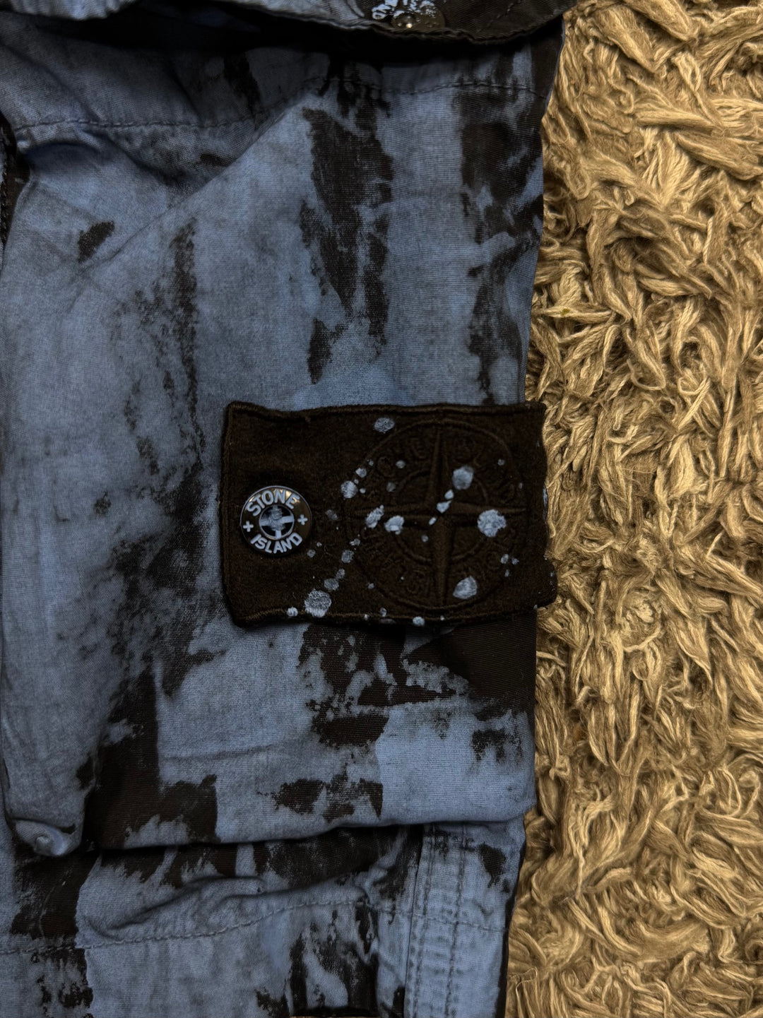 Stone Island Bermuda Customized